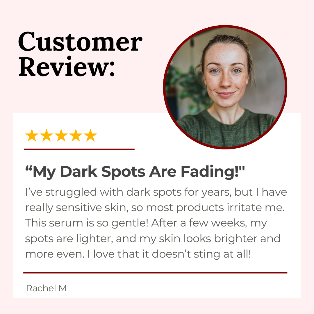 Dark Spot Serum for Sensitive Skin